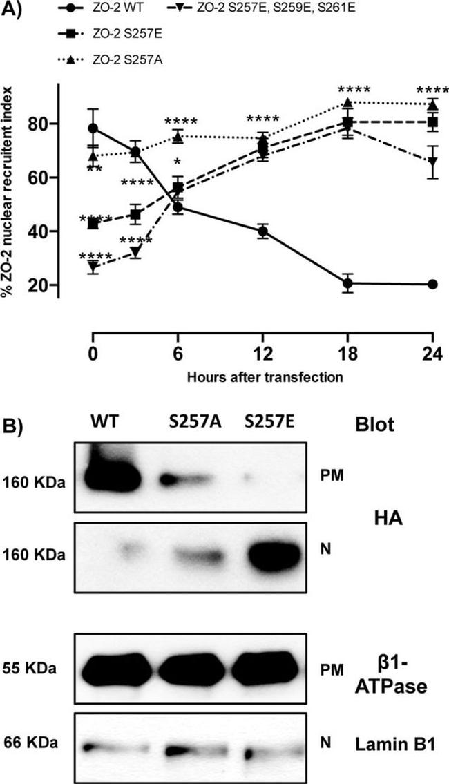 Lamin B1 Antibody in Western Blot (WB)