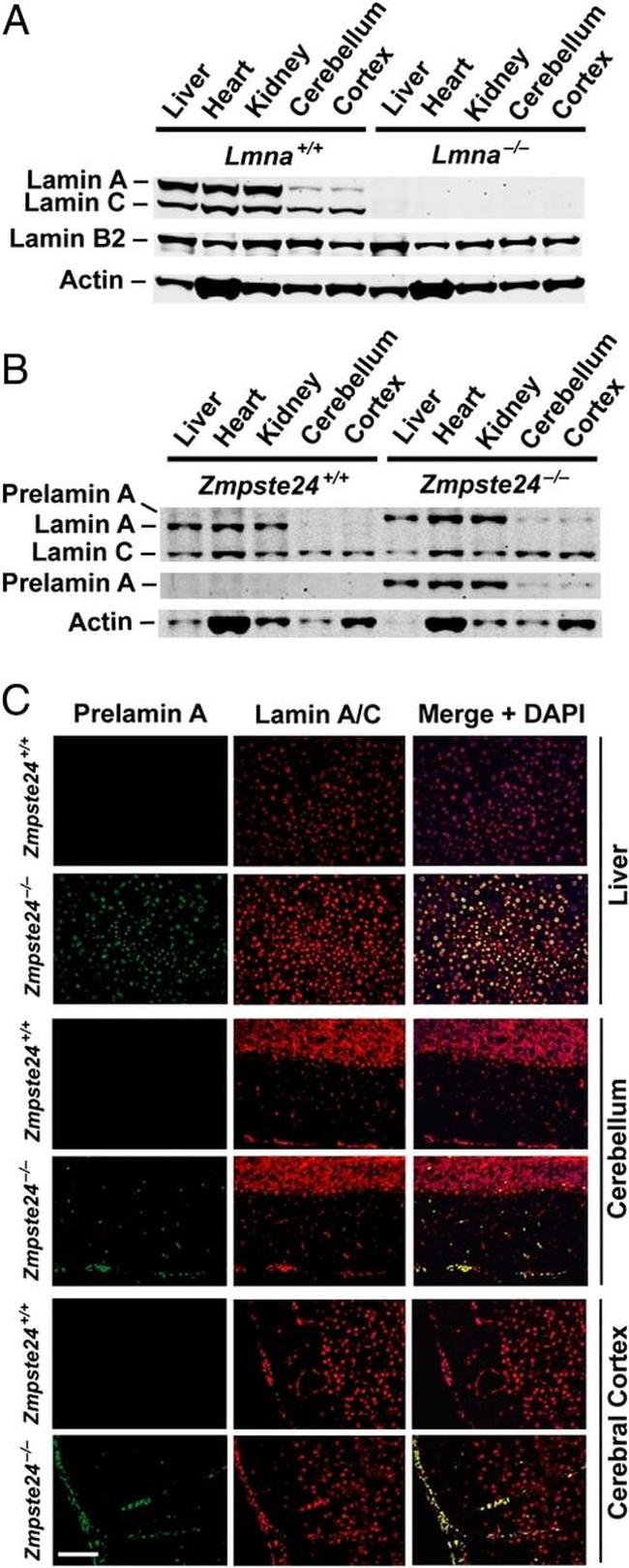 Lamin B2 Antibody in Western Blot, Immunohistochemistry (WB, IHC)