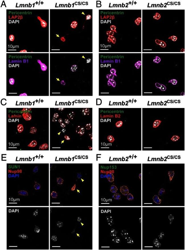 Lamin B2 Antibody in Immunocytochemistry (ICC/IF)
