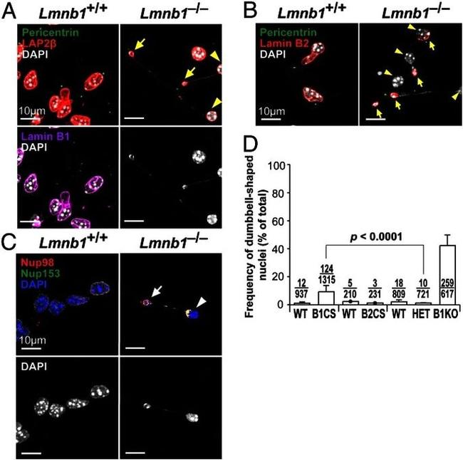 Lamin B2 Antibody in Immunocytochemistry (ICC/IF)