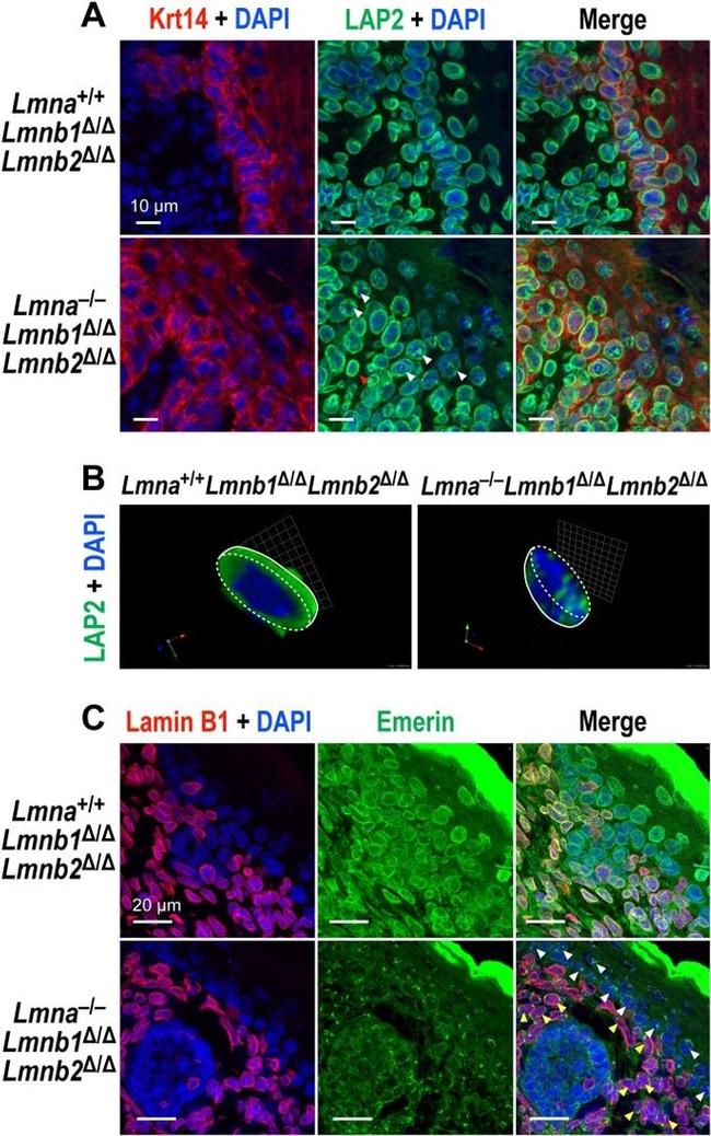 Lamin B2 Antibody in Immunohistochemistry (IHC)