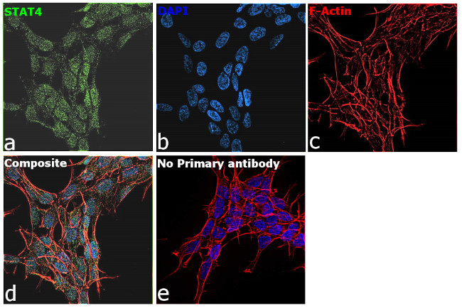 STAT4 Antibody in Immunocytochemistry (ICC/IF)