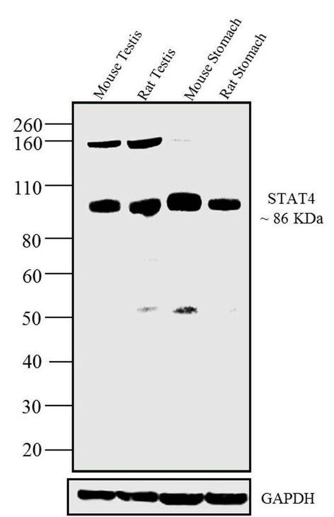 STAT4 Antibody in Western Blot (WB)