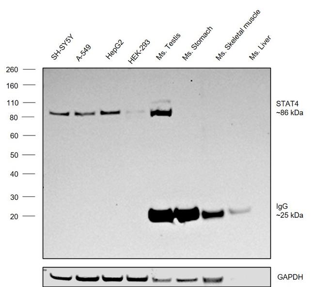 STAT4 Antibody in Western Blot (WB)