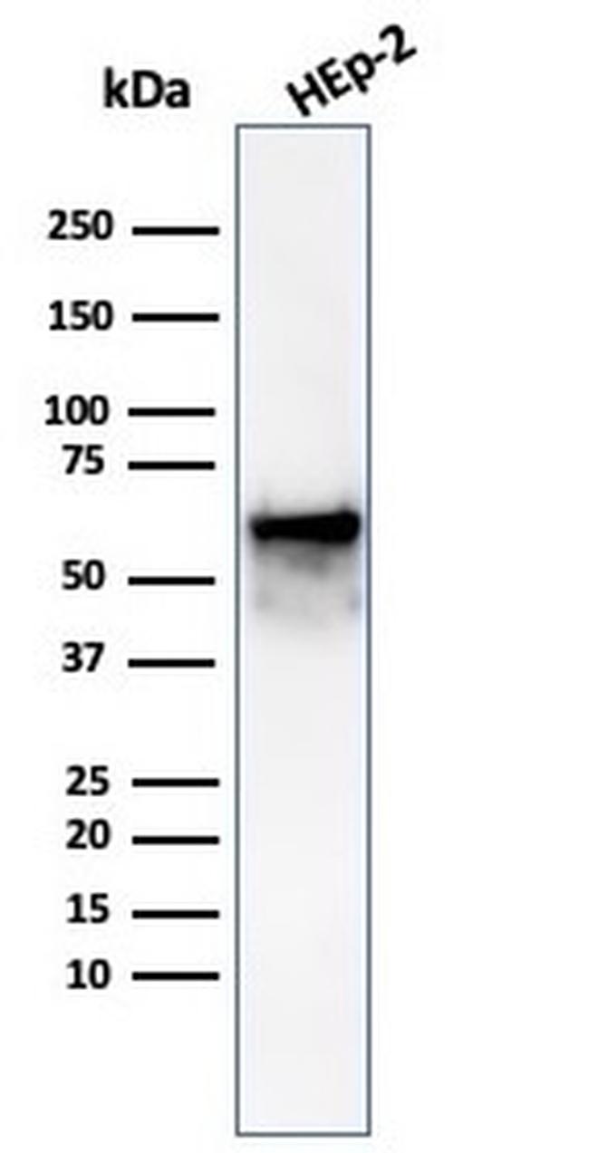 HSP60 (Heat Shock Protein 60) Antibody in Western Blot (WB)