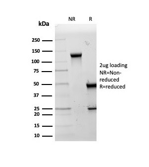 HSP60 (Heat Shock Protein 60) (Mitochondrial Marker) Antibody in SDS-PAGE (SDS-PAGE)