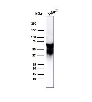 HSP60 (Heat Shock Protein 60) (Mitochondrial Marker) Antibody in Western Blot (WB)