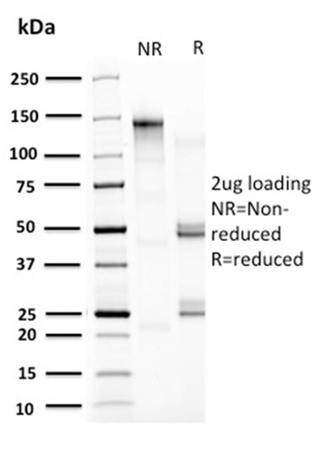 HSP60 (Heat Shock Protein 60) Antibody in SDS-PAGE (SDS-PAGE)