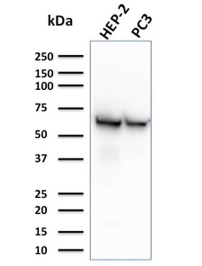 HSP60 (Heat Shock Protein 60) Antibody in Western Blot (WB)