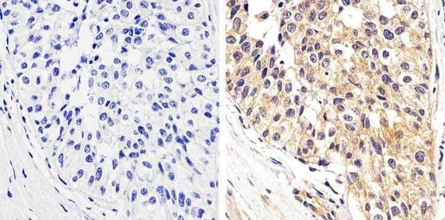 Phospho-STAT1 (Tyr701) Antibody in Immunohistochemistry (Paraffin) (IHC (P))