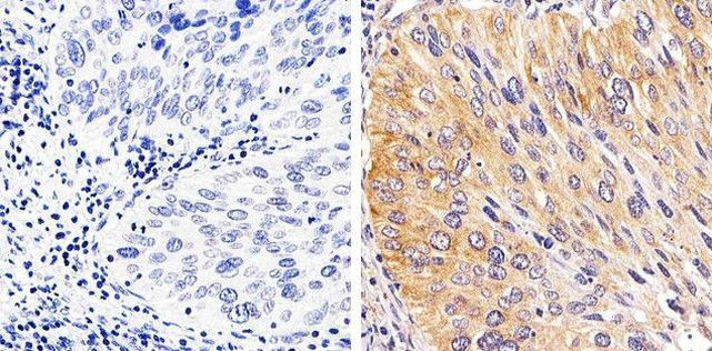 Phospho-STAT1 (Tyr701) Antibody in Immunohistochemistry (Paraffin) (IHC (P))