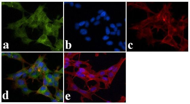 Ankyrin B Antibody in Immunocytochemistry (ICC/IF)