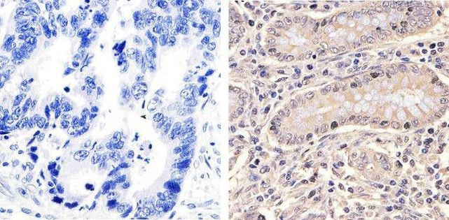 HSP70 Antibody in Immunohistochemistry (Paraffin) (IHC (P))