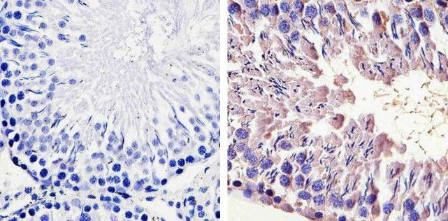 HSP70 Antibody in Immunohistochemistry (Paraffin) (IHC (P))