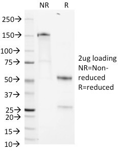 Heparan Sulfate Proteoglycan (Large)/Perlecan Antibody in SDS-PAGE (SDS-PAGE)