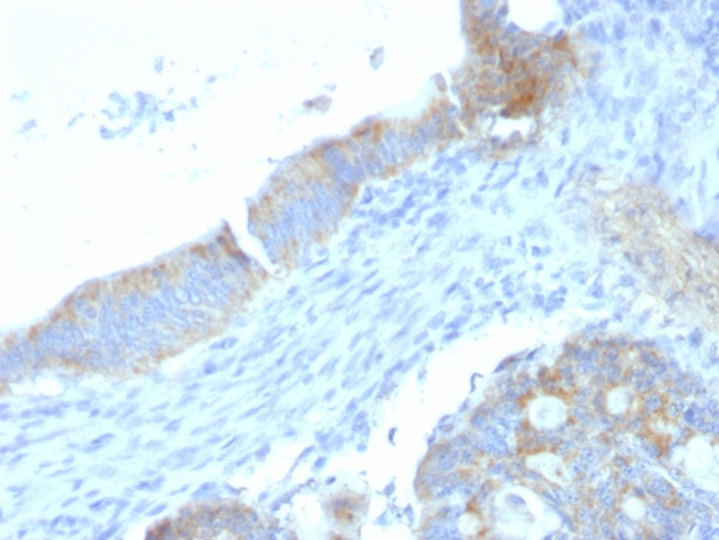 Heparan Sulfate Proteoglycan (Large)/Perlecan Antibody in Immunohistochemistry (Paraffin) (IHC (P))