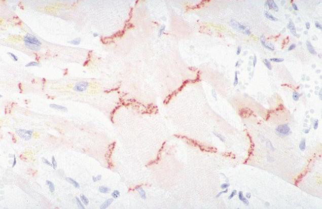 N-cadherin Antibody in Immunohistochemistry (IHC)