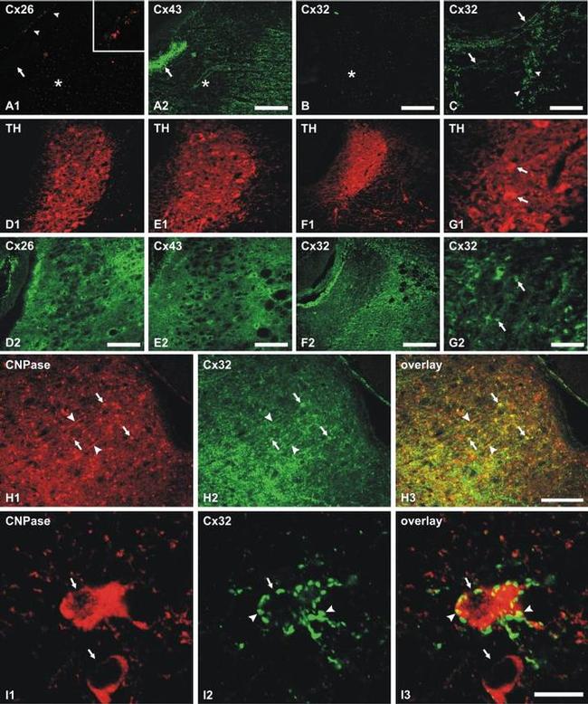 Connexin 43 Antibody in Immunohistochemistry (IHC)