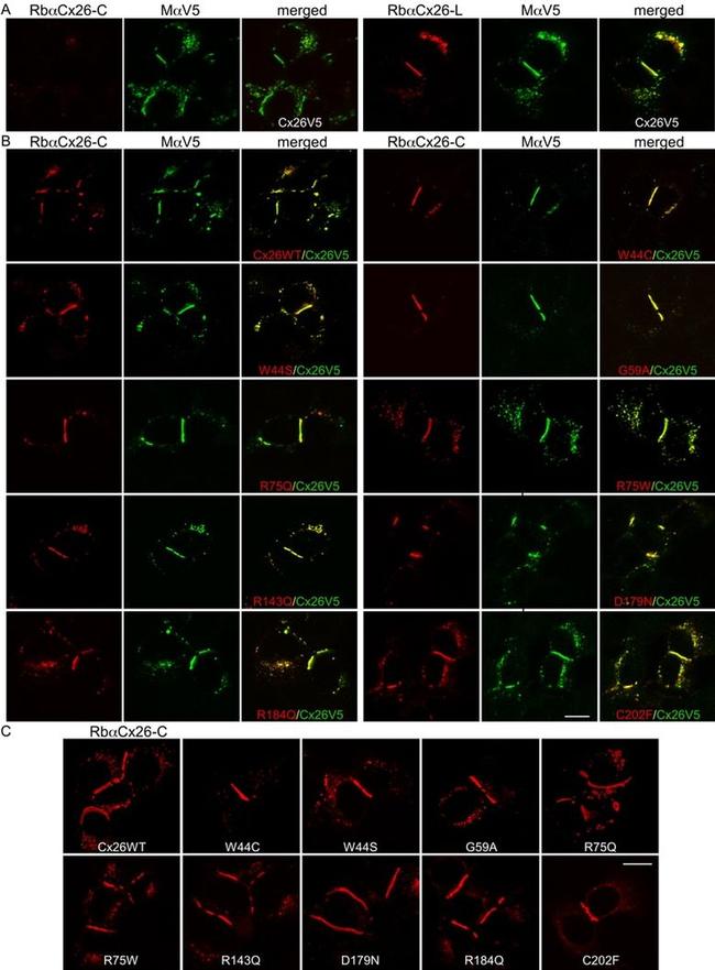 Connexin 26 Antibody in Immunocytochemistry (ICC/IF)