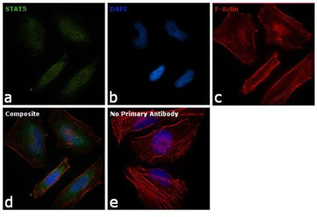 STAT5 alpha/beta Antibody in Immunocytochemistry (ICC/IF)