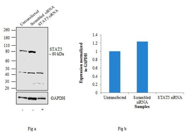 STAT5 alpha/beta Antibody in Western Blot (WB)