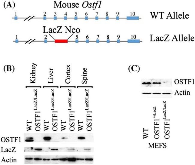 beta Galactosidase Antibody in Western Blot (WB)