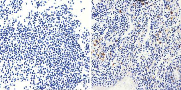 Bax Antibody in Immunohistochemistry (Paraffin) (IHC (P))