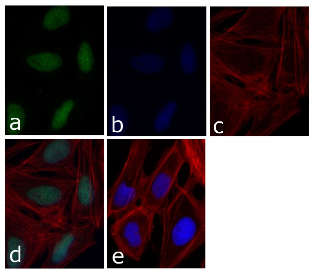 p21 Antibody in Immunocytochemistry (ICC/IF)