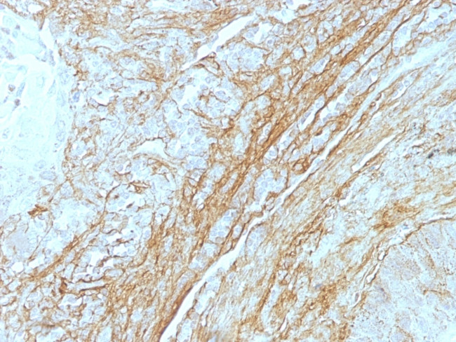 Tenascin C (Stromal Marker for Epithelial Malignancy) Antibody in Immunohistochemistry (Paraffin) (IHC (P))