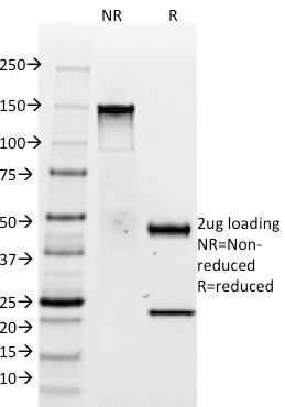 Tenascin C (Stromal Marker for Epithelial Malignancy) Antibody in SDS-PAGE (SDS-PAGE)