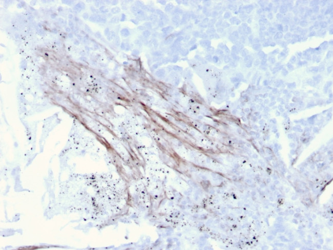 Tenascin C Antibody in Immunohistochemistry (Paraffin) (IHC (P))