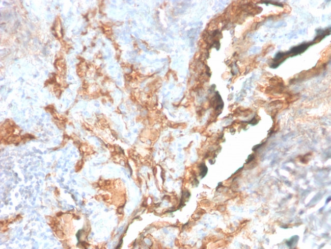 Tenascin C Antibody in Immunohistochemistry (Paraffin) (IHC (P))