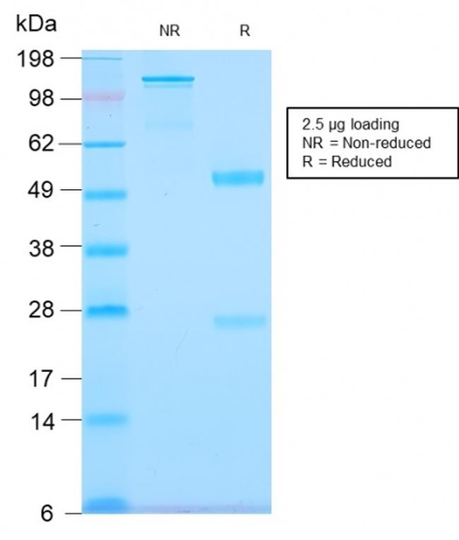 Tenascin C Antibody in SDS-PAGE (SDS-PAGE)