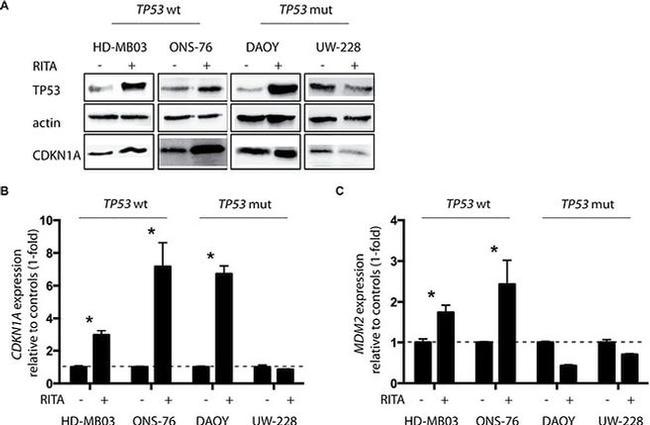 MDM2 Antibody in Western Blot (WB)