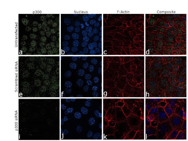 p300 Antibody in Immunocytochemistry (ICC/IF)