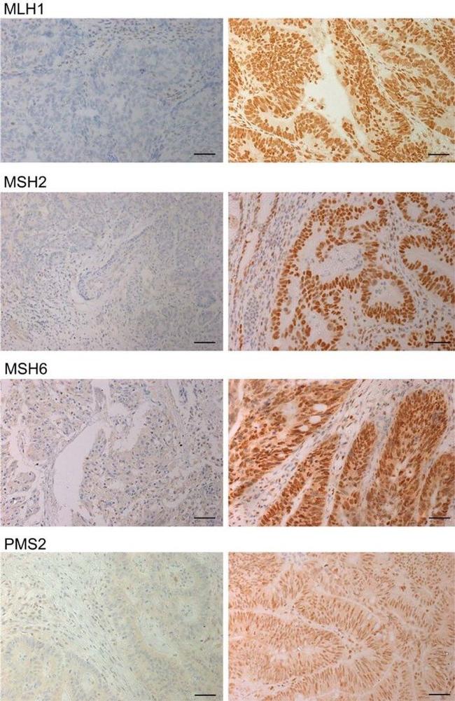 MSH2 Antibody in Immunohistochemistry (IHC)