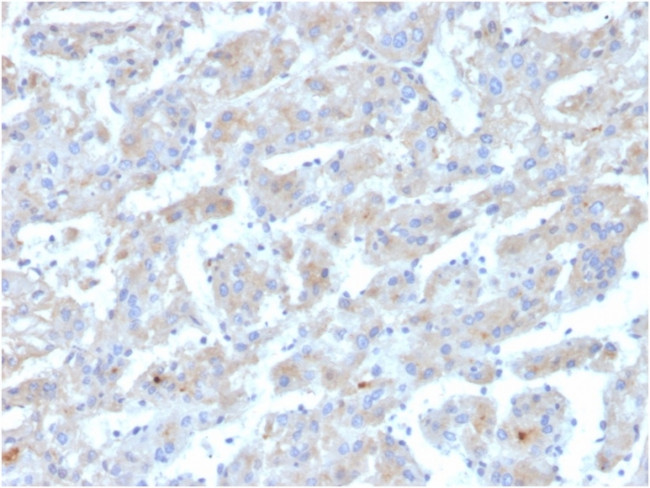 Apolipoprotein B /APOB Antibody in Immunohistochemistry (Paraffin) (IHC (P))