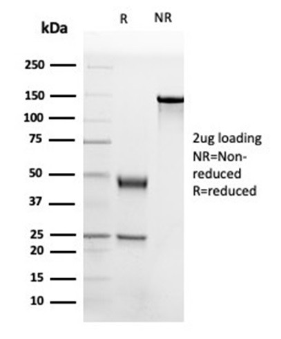 Apolipoprotein B/APOB Antibody in SDS-PAGE (SDS-PAGE)