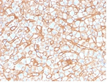 Apolipoprotein B/APOB Antibody in Immunohistochemistry (Paraffin) (IHC (P))