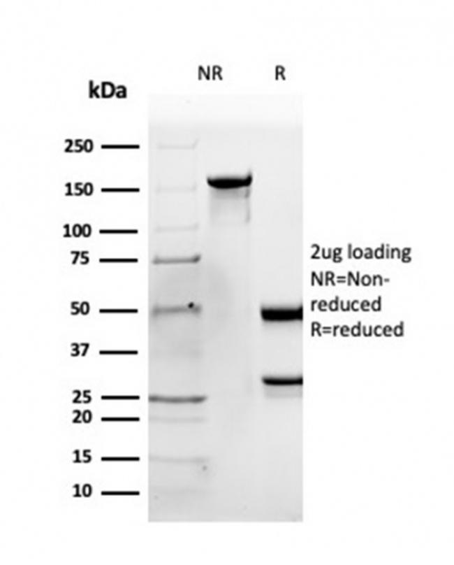 Apolipoprotein B /APOB Antibody in SDS-PAGE (SDS-PAGE)