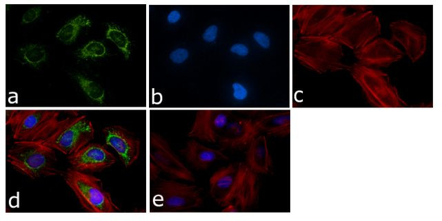 p38 MAPK beta Antibody in Immunocytochemistry (ICC/IF)