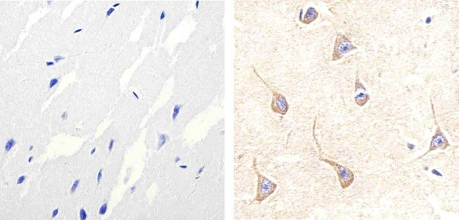 p38 MAPK beta Antibody in Immunohistochemistry (Paraffin) (IHC (P))