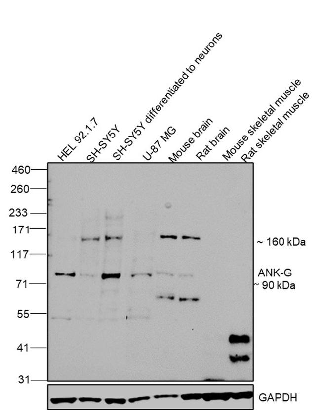 Ankyrin G Antibody in Western Blot (WB)