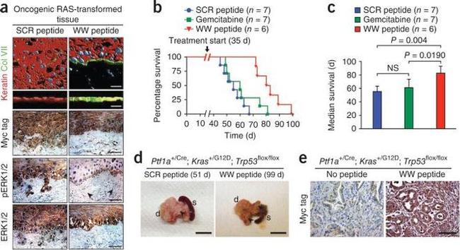 IQGAP1 Antibody in Immunohistochemistry (IHC)