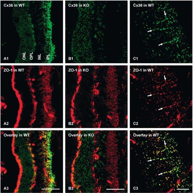 Connexin 36 Antibody in Immunohistochemistry (IHC)