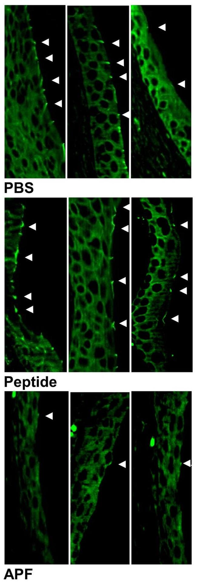 ZO-1 Antibody in Immunohistochemistry (Paraffin) (IHC (P))