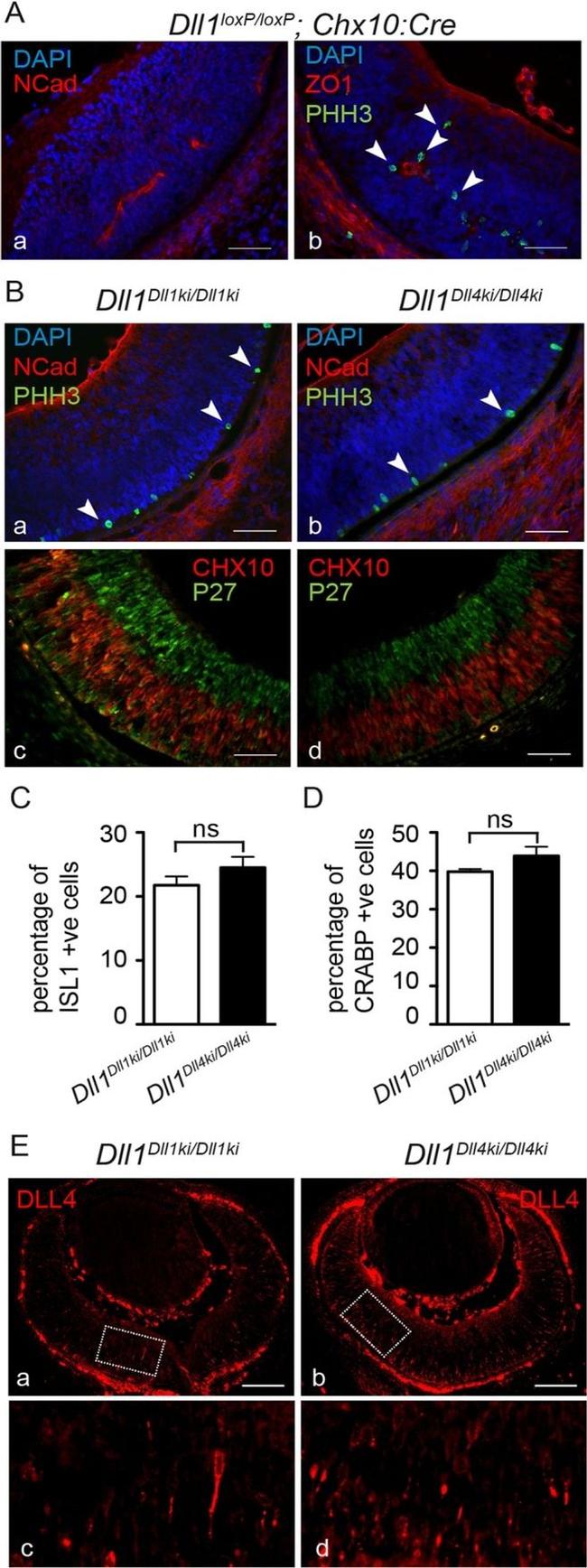 p27 Kip1 Antibody in Immunohistochemistry (IHC)