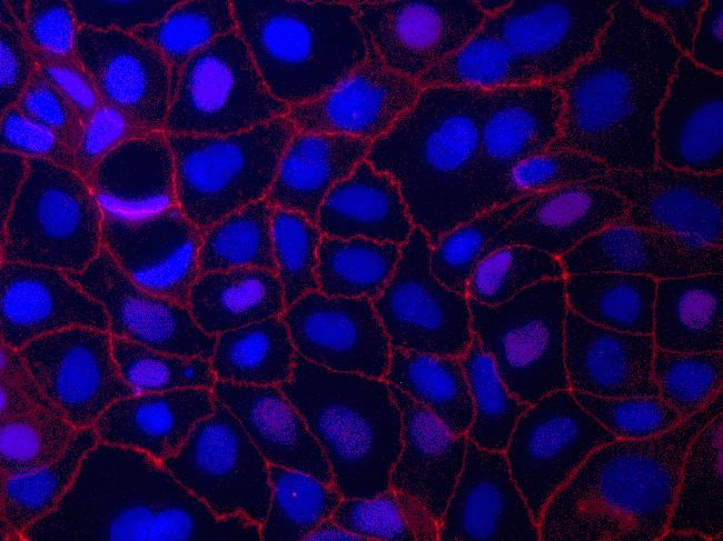 ZO-1 Antibody in Immunocytochemistry (ICC/IF)