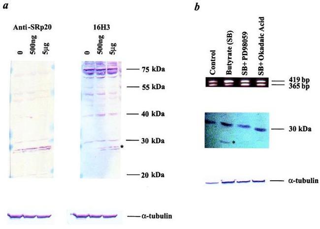 SR Antibody in Western Blot (WB)