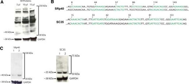 SR Antibody in Western Blot (WB)